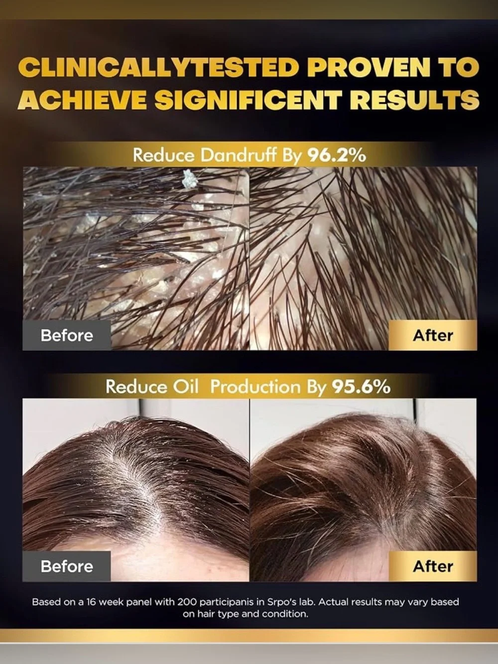 Biotin Shampoo & Conditioner Set – 2 x 13 oz – Hair Care